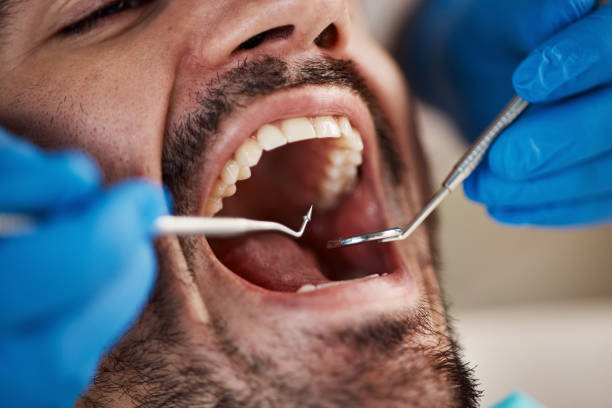 Best Broken Tooth Emergency  in Pine, AZ